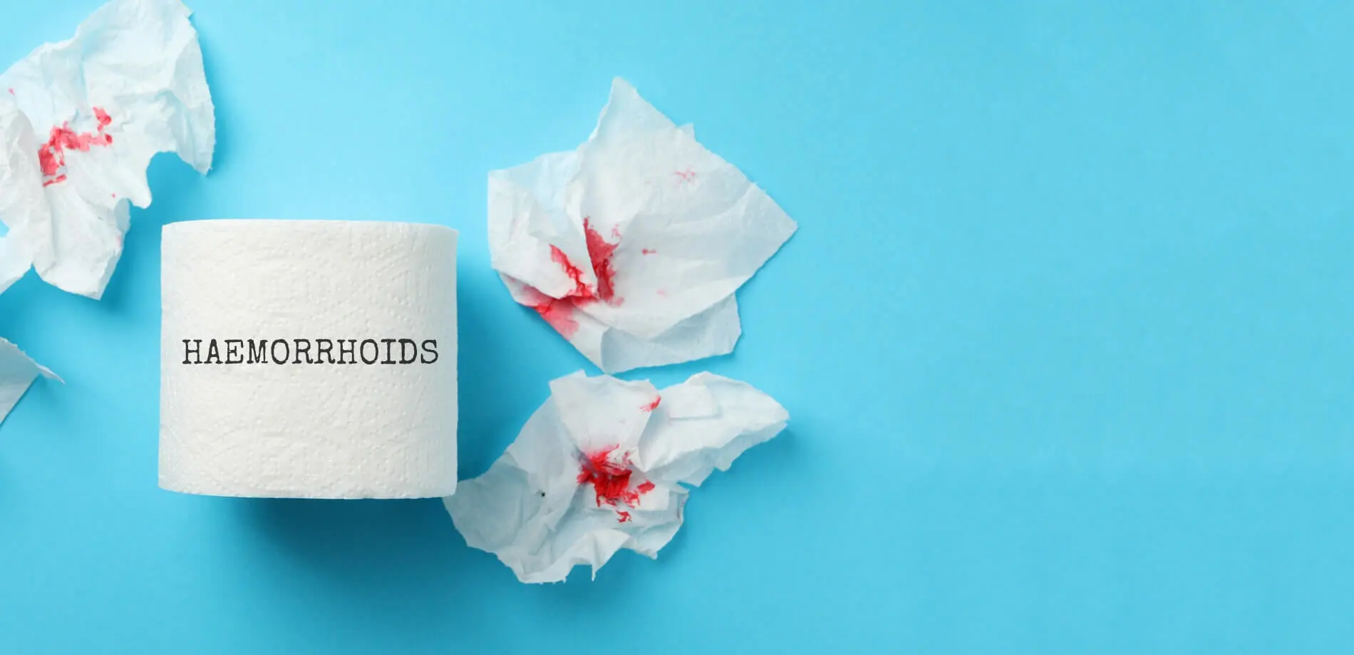 Haemorrhoids