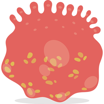Genital Herpes