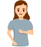 Infections
