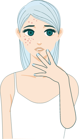 Acne/Rosacea