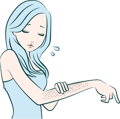 hirsutism treatment