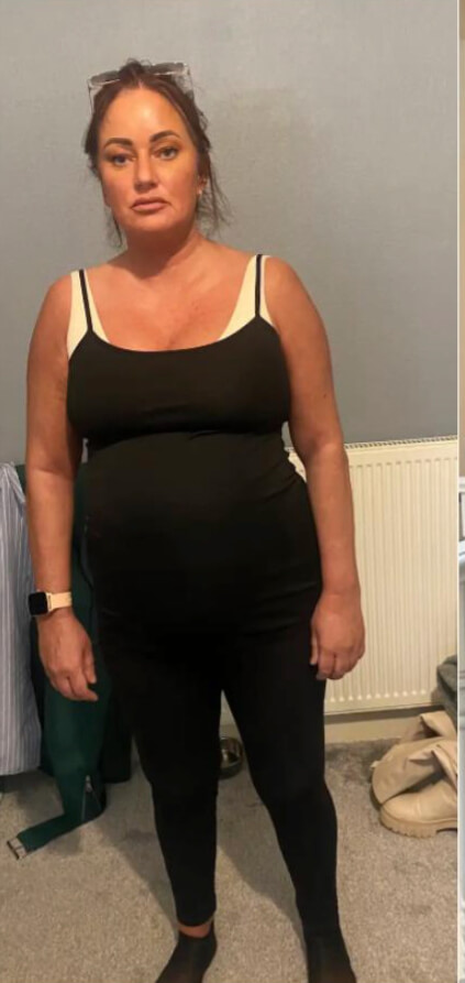 Katie's Story before