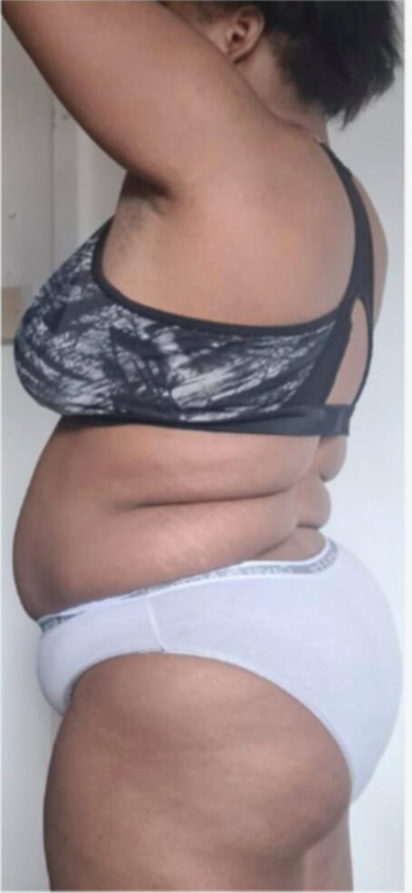 Isoloma Wegovy Weight Loss Story | Pharmacy Planet UK