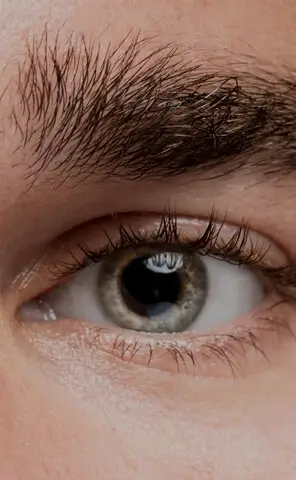 eye glaucoma